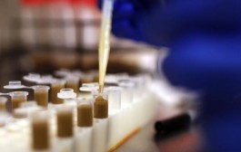 Des matières fécales plus efficaces que les antibiotiques ?