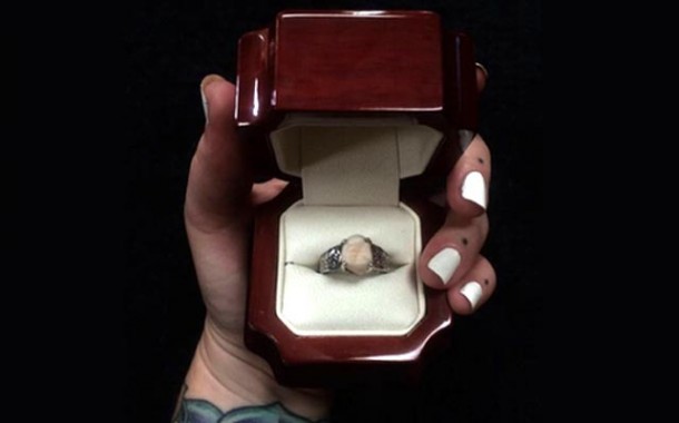 Il sertit une bague de sa dent de sagesse pour sa demande en mariage