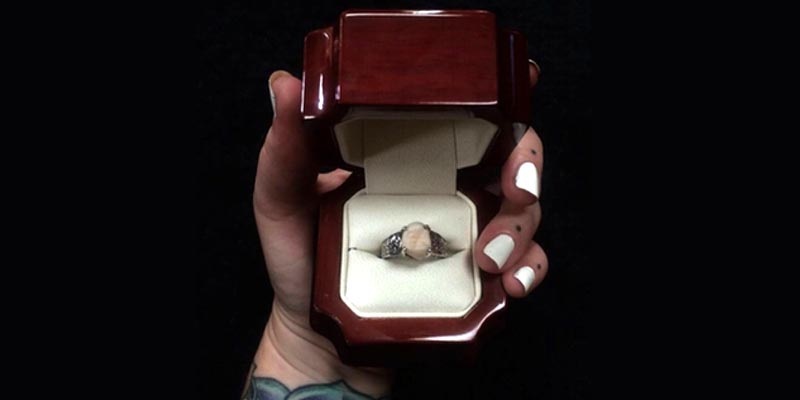 Il sertit une bague de sa dent de sagesse pour sa demande en mariage